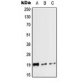 LifeSab™ Calcitonin Rabbit pAb (50 µl)