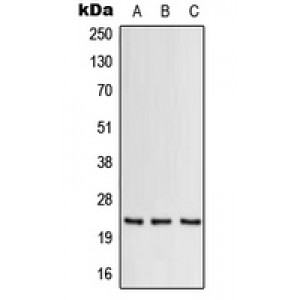 LifeSab™ GM-CSF Rabbit pAb (50 µl)