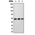 LifeSab™ Cytochrome P450 8B1 Rabbit pAb (50 µl)