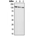 LifeSab™ NMDAR2C Rabbit pAb (50 µl)