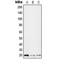 LifeSab™ IL-2 Rabbit pAb (50 µl)