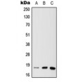 LifeSab™ MTH1 Rabbit pAb (50 µl)