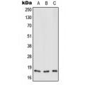 LifeSab™ MT-ND3 Rabbit pAb (50 µl)