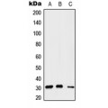 LifeSab™ Gemin2 Rabbit pAb (50 µl)