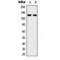 LifeSab™ ULK2 Rabbit pAb (50 µl)