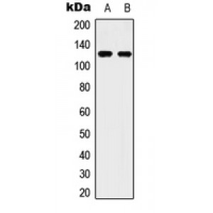 LifeSab™ ULK2 Rabbit pAb (50 µl)