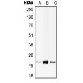 LifeSab™ CIB1 Rabbit pAb (50 µl)