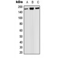 LifeSab™ PHLPP Rabbit pAb (50 µl)