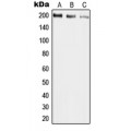 LifeSab™ UBR2 Rabbit pAb (50 µl)