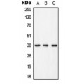 LifeSab™ LAT (pY255) Rabbit pAb (50 µl)