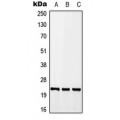 LifeSab™ CALY Rabbit pAb (50 µl)
