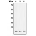 LifeSab™ LSM2 Rabbit pAb (50 µl)