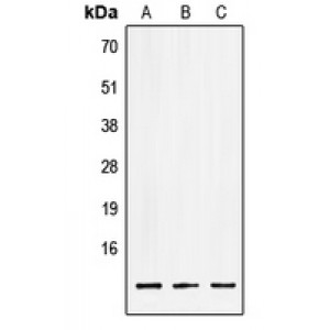 LifeSab™ LSM2 Rabbit pAb (50 µl)