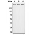 LifeSab™ GPR112 Rabbit pAb (50 µl)