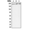 LifeSab™ Complement C4A/B Rabbit pAb (50 µl)