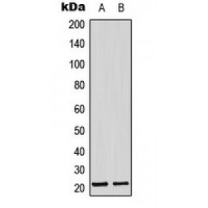 LifeSab™ Adrenomedullin Rabbit pAb (50 µl)