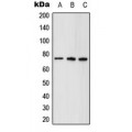 LifeSab™ ABCD1 Rabbit pAb (50 µl)