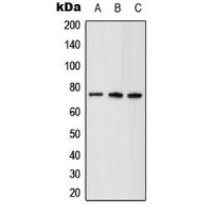 LifeSab™ ABCD1 Rabbit pAb (50 µl)