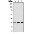LifeSab™ BCL2 (pS70) Rabbit pAb (50 µl)