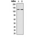 LifeSab™ EPHB4 Rabbit pAb (50 µl)
