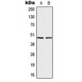 LifeSab™ IRF4 Rabbit pAb (50 µl)