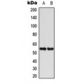 LifeSab™ Cytokeratin 8 Rabbit pAb (50 µl)