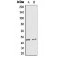 LifeSab™ Cytokeratin 18 (pS33) Rabbit pAb (50 µl)