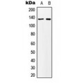LifeSab™ MN1 Rabbit pAb (50 µl)