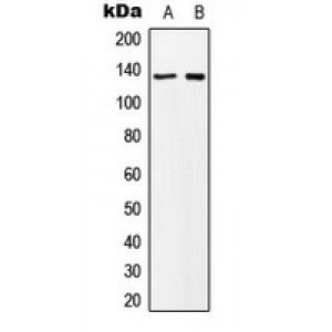 LifeSab™ MN1 Rabbit pAb (50 µl)