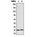 LifeSab™ MYF6 Rabbit pAb (50 µl)