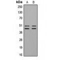 LifeSab™ VASP (pS157) Rabbit pAb (50 µl)