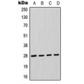 LifeSab™ FADD Rabbit pAb (50 µl)