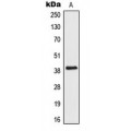 LifeSab™ AIM2 Rabbit pAb (50 µl)
