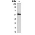 LifeSab™ CD2BP2 Rabbit pAb (50 µl)