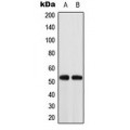 LifeSab™ ACOT2 Rabbit pAb (50 µl)