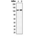 LifeSab™ NGEP Rabbit pAb (50 µl)