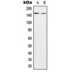LifeSab™ HECW2 Rabbit pAb (50 µl)