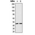 LifeSab™ ACOT4 Rabbit pAb (50 µl)