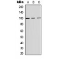 LifeSab™ ADAM12 Rabbit pAb (50 µl)