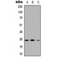 LifeSab™ Adipsin Rabbit pAb (50 µl)