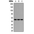 LifeSab™ Antithrombin III Rabbit pAb (50 µl)