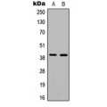 LifeSab™ Ataxin 7L3 Rabbit pAb (50 µl)