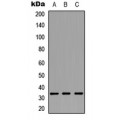 LifeSab™ Calponin 1 Rabbit pAb (50 µl)