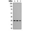 LifeSab™ CAPNS2 Rabbit pAb (50 µl)