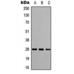 LifeSab™ CAPNS2 Rabbit pAb (50 µl)