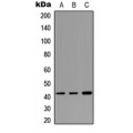 LifeSab™ Cathepsin W Rabbit pAb (50 µl)