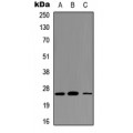 LifeSab™ CD354 Rabbit pAb (50 µl)