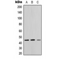 LifeSab™ CTH Rabbit pAb (50 µl)