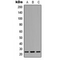 LifeSab™ Dectin 2 Rabbit pAb (50 µl)