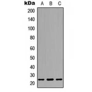 LifeSab™ Dectin 2 Rabbit pAb (50 µl)